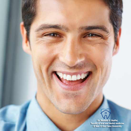 Aesthetic Inlays_Onlays